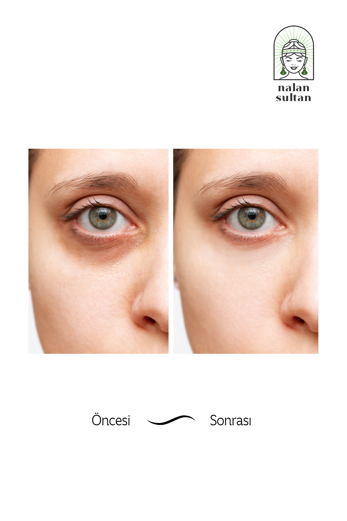 Sultan Göz Bakım Serumu | Üzüm Çekirdeği Yağlı %100 Doğal Gözaltı Kırışıklık Karşıtı (10 ml)