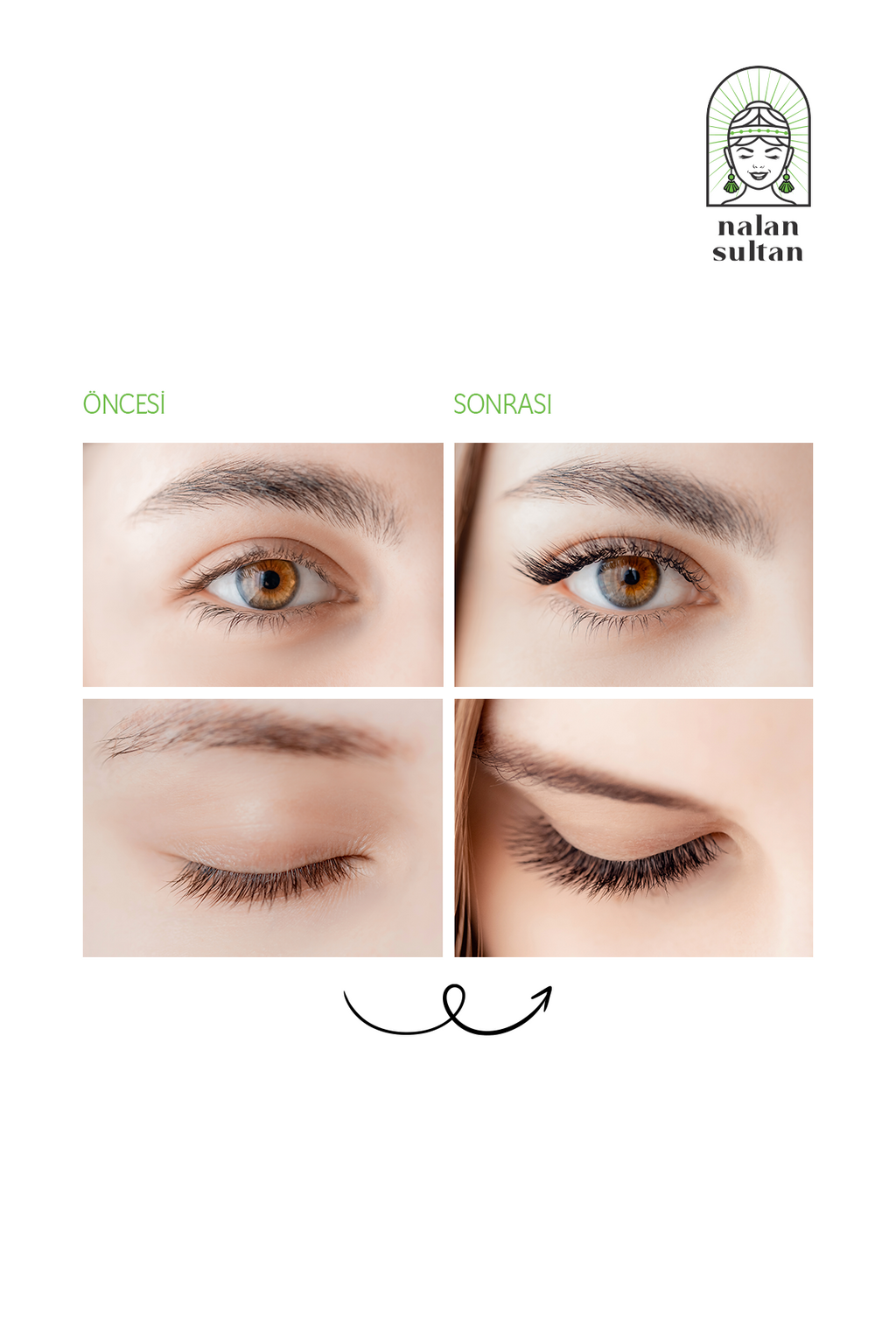 Kaş ve Kirpik Bakım Yağı | %100 Bitkisel Yıpranmış Kirpiklere Özel Selvi Yağlı Bakım Yağı (10ml)