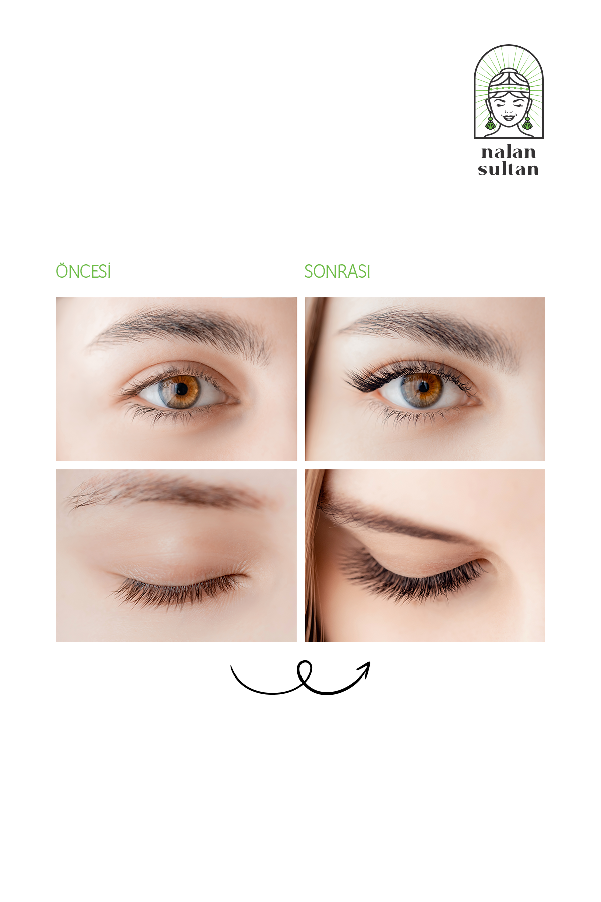 Kaş ve Kirpik Bakım Yağı | %100 Bitkisel Yıpranmış Kirpiklere Özel Selvi Yağlı Bakım Yağı (10ml)