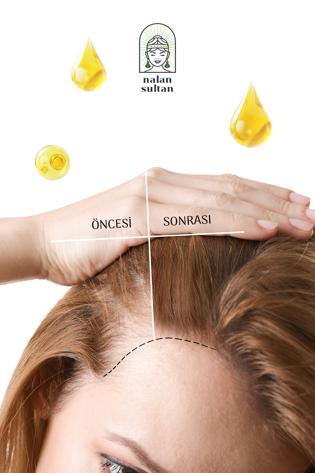 Saç Dökülmesine Karşı Serum | Biberiye Yağı İçeren Saç Bakım Yağı, Saç Uzatır (50 ml)